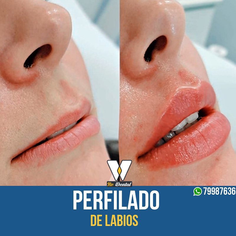 Re-Dental - imagen 2