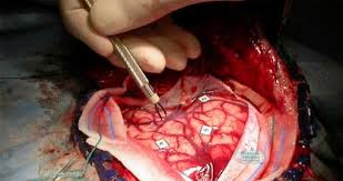 Dr. Olmos - imagen 4